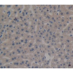 CREB Binding Protein (CREBBP) Antibody