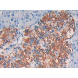 Epidermal Growth Factor (EGF) Antibody