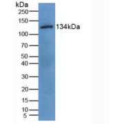 Western blot analysis of Pig Uterus Tissue.