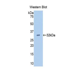 Epidermal Growth Factor (EGF) Antibody