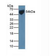 Western blot analysis of Human Serum.