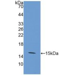 Solute Carrier Family 2, Facilitated Glucose Transporter Member 1 (SLC2A1) Antibody