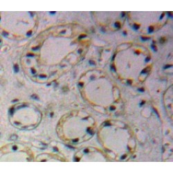 Solute Carrier Family 2, Facilitated Glucose Transporter Member 1 (SLC2A1) Antibody