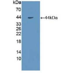 Somatotropin Receptor (GHR) Antibody