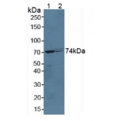 Somatotropin Receptor (GHR) Antibody