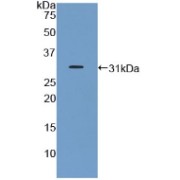 Western blot analysis of recombinant Mouse GHR.