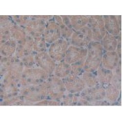 Somatotropin Receptor (GHR) Antibody