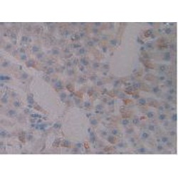 Somatotropin Receptor (GHR) Antibody