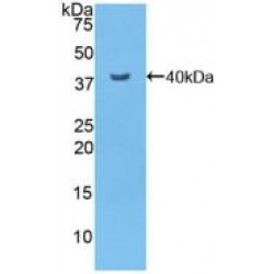 Nuclear Factor Kappa B (NFkB) Antibody