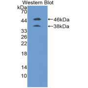 Western blot analysis of the recombinant protein.