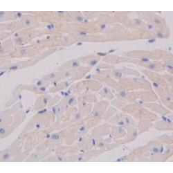 Placenta Growth Factor (PLGF) Antibody