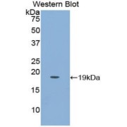 Western blot analysis of the recombinant protein.