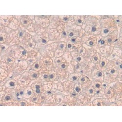 Placenta Growth Factor (PLGF) Antibody