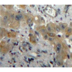 Placenta Growth Factor (PLGF) Antibody