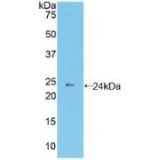 Western blot analysis of recombinant Mouse PCDHb2.