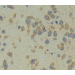 Protocadherin Beta 2 (PCDHb2) Antibody