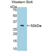 Western blot analysis of the recombinant protein.