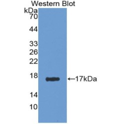 Agmatine Ureohydrolase (AGMAT) Antibody