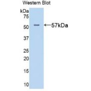 Western blot analysis of the recombinant protein.