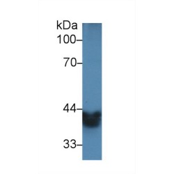 Alcohol Dehydrogenase 1 (ADH1) Antibody