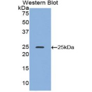 Western blot analysis of recombinant Mouse ADH1 Protein.