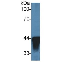 Alcohol Dehydrogenase 1 (ADH1) Antibody