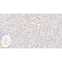 Alcohol Dehydrogenase 1 (ADH1) Antibody