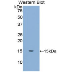 Carcinoembryonic Antigen-Related Cell Adhesion Molecule 5 (CEACAM5) Antibody