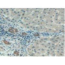 Complement 1 Inhibitor (C1INH) Antibody