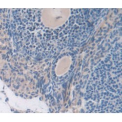 Complement 1 Inhibitor (C1INH) Antibody