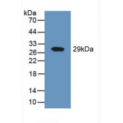 Dipeptidyl Peptidase 4 / CD26 (DPP4) Antibody