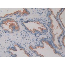 Dipeptidyl Peptidase 4 / CD26 (DPP4) Antibody