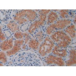 Dipeptidyl Peptidase 4 / CD26 (DPP4) Antibody