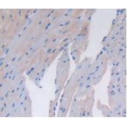 Dipeptidyl Peptidase 4 / CD26 (DPP4) Antibody