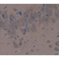 Dipeptidyl Peptidase 4 / CD26 (DPP4) Antibody