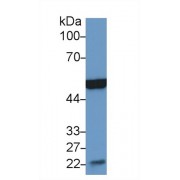 Western blot analysis of Mouse Heart lysate, using Mouse MSE Antibody (2 µg/ml) and HRP-conjugated Goat Anti-Rabbit antibody (<a href="https://www.abbexa.com/index.php?route=product/search&amp;search=abx400043" target="_blank">abx400043</a>, 0.2 µg/ml).