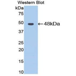 Enolase, Muscle Specific (MSE) Antibody