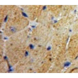 Enolase, Muscle Specific (MSE) Antibody