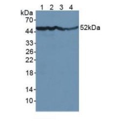 Enolase, Neuron Specific (NSE) Antibody