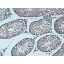 Enolase, Neuron Specific (NSE) Antibody