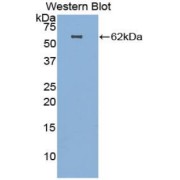 Western blot analysis of the recombinant protein.