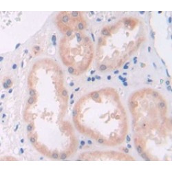 Hepatocyte Growth Factor (HGF) Antibody