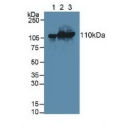 Western blot analysis of (1) Human HeLa cells, (2) Mouse Spleen Tissue and (3) Mouse Pancreas Tissue.