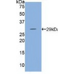 Hexokinase 3, White Cell (HK3) Antibody