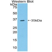 Western blot analysis of the recombinant protein.