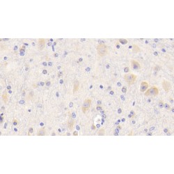 Beta-Amyloid Precursor Protein (APP) Antibody