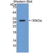 Western blot analysis of recombinant Mouse APP.
