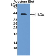 Western blot analysis of the recombinant protein.