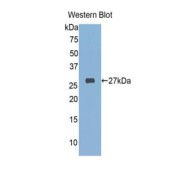 Western blot analysis of the recombinant protein.