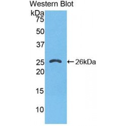 FK506 Binding Protein 8 (FKBP8) Antibody